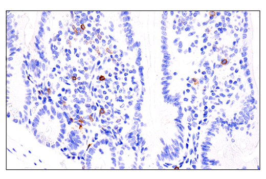 Immunohistochemistry Image 6: IL-2Rα/CD25 (E4B2Z) XP® Rabbit mAb