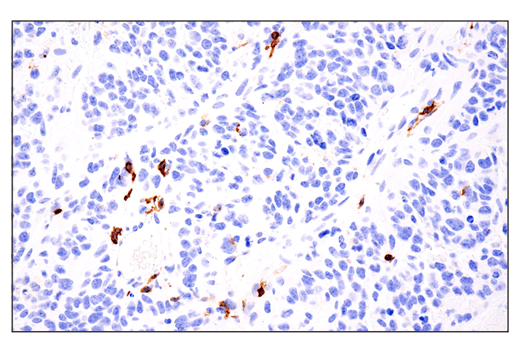 Immunohistochemistry Image 7: IL-2Rα/CD25 (E4B2Z) XP® Rabbit mAb
