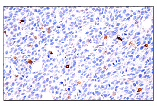 Immunohistochemistry Image 8: IL-2Rα/CD25 (E4B2Z) XP® Rabbit mAb