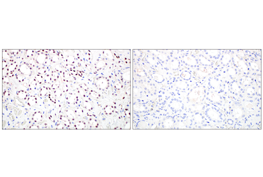  Image 62: Small Cell Lung Cancer Biomarker Antibody Sampler Kit