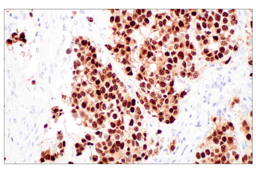  Image 36: Small Cell Lung Cancer Biomarker Antibody Sampler Kit