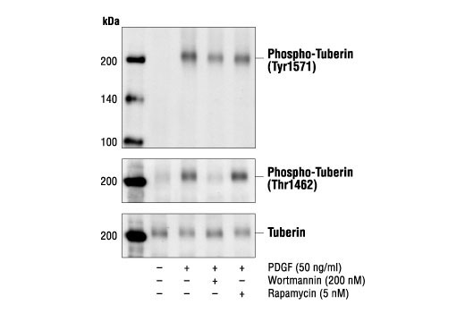 Western Blotting Image 1: Phospho-Tuberin/TSC2 (Tyr1571) Antibody