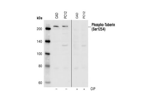 Western Blotting Image 1: Phospho-Tuberin/TSC2 (Ser1254) Antibody