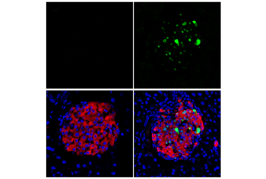 Immunofluorescence Image 1: Cre Recombinase (D7L7L) XP® Rabbit mAb (Alexa Fluor® 488 Conjugate)