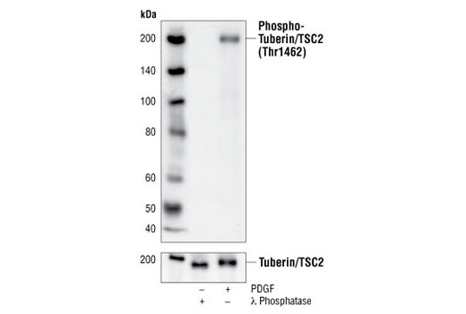 Western Blotting Image 1: Phospho-Tuberin/TSC2 (Thr1462) (5B12) Rabbit mAb