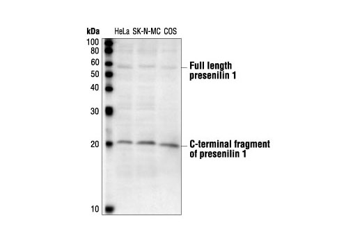 Western Blotting Image 1: Presenilin 1 Antibody