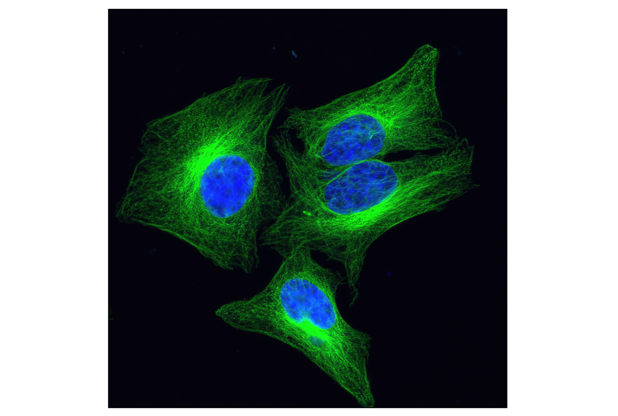 Immunofluorescence Image 1: β-Tubulin (9F3) Rabbit mAb (Alexa Fluor® 488 Conjugate)