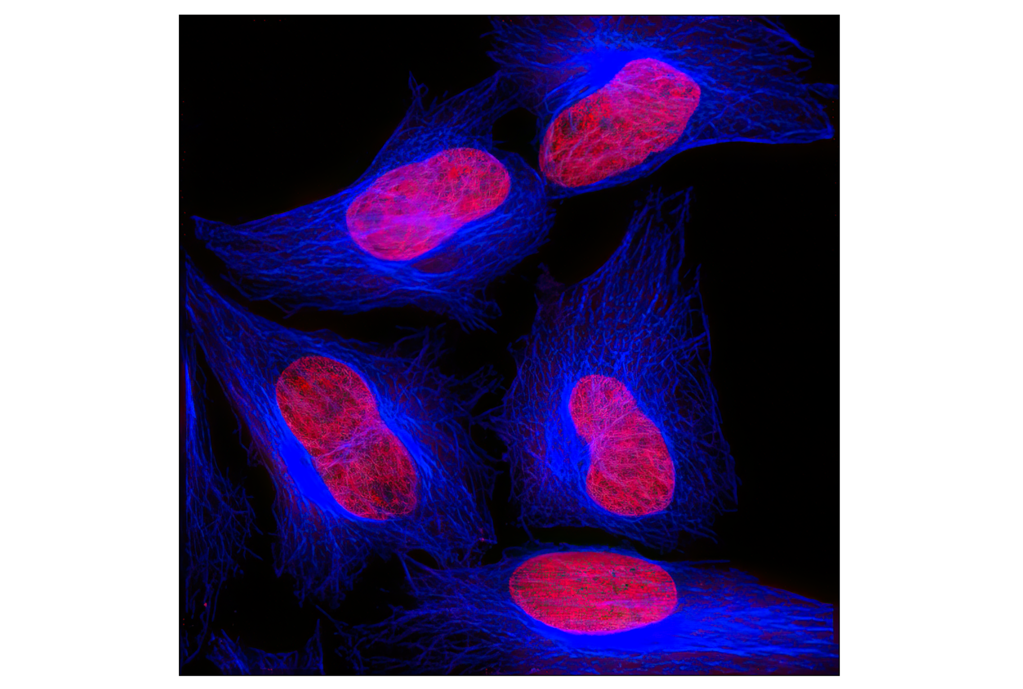 Immunofluorescence Image 1: β-Tubulin (9F3) Rabbit mAb (Alexa Fluor® 647 Conjugate)