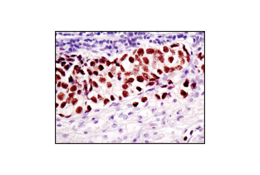 Immunohistochemistry Image 2: NUT (C52B1) Rabbit mAb