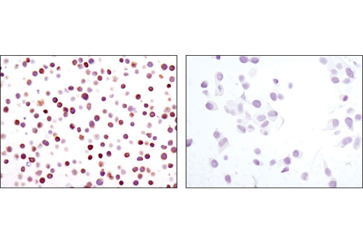 Immunohistochemistry Image 4: NFAT1 (D43B1) XP® Rabbit mAb (BSA and Azide Free)