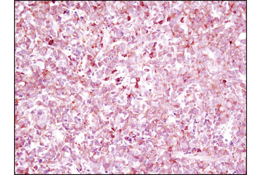 Immunohistochemistry Image 3: NFAT1 (D43B1) XP® Rabbit mAb (BSA and Azide Free)