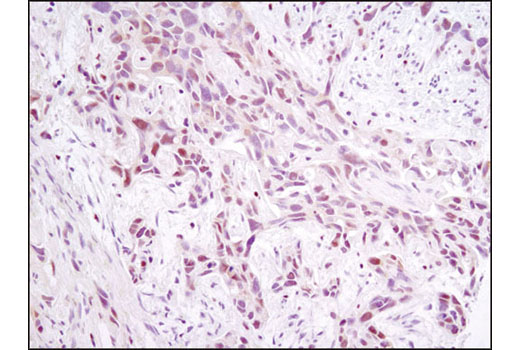 Immunohistochemistry Image 1: NFAT1 (D43B1) XP® Rabbit mAb (BSA and Azide Free)