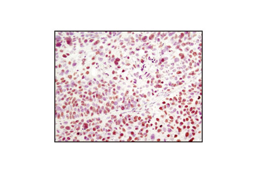Immunohistochemistry Image 1: Histone H2A (L88A6) Mouse mAb