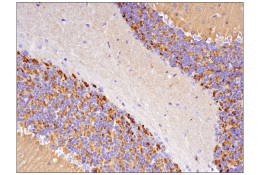  Image 21: Mature Neuron Marker Antibody Sampler Kit
