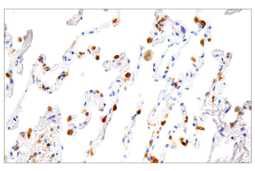 Immunohistochemistry Image 7: LRRK2 (E8Z7T) Mouse mAb