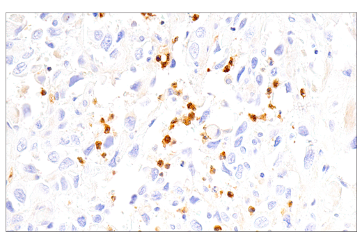 Immunohistochemistry Image 3: LRRK2 (E8Z7T) Mouse mAb