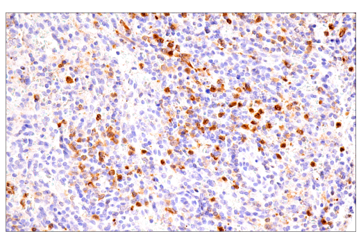 Immunohistochemistry Image 6: LRRK2 (E8Z7T) Mouse mAb