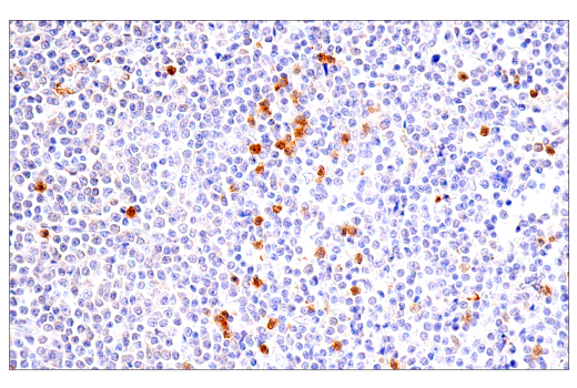 Immunohistochemistry Image 2: LRRK2 (E8Z7T) Mouse mAb