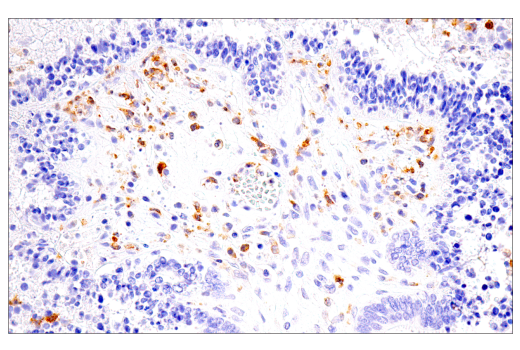 Immunohistochemistry Image 4: LRRK2 (E8Z7T) Mouse mAb