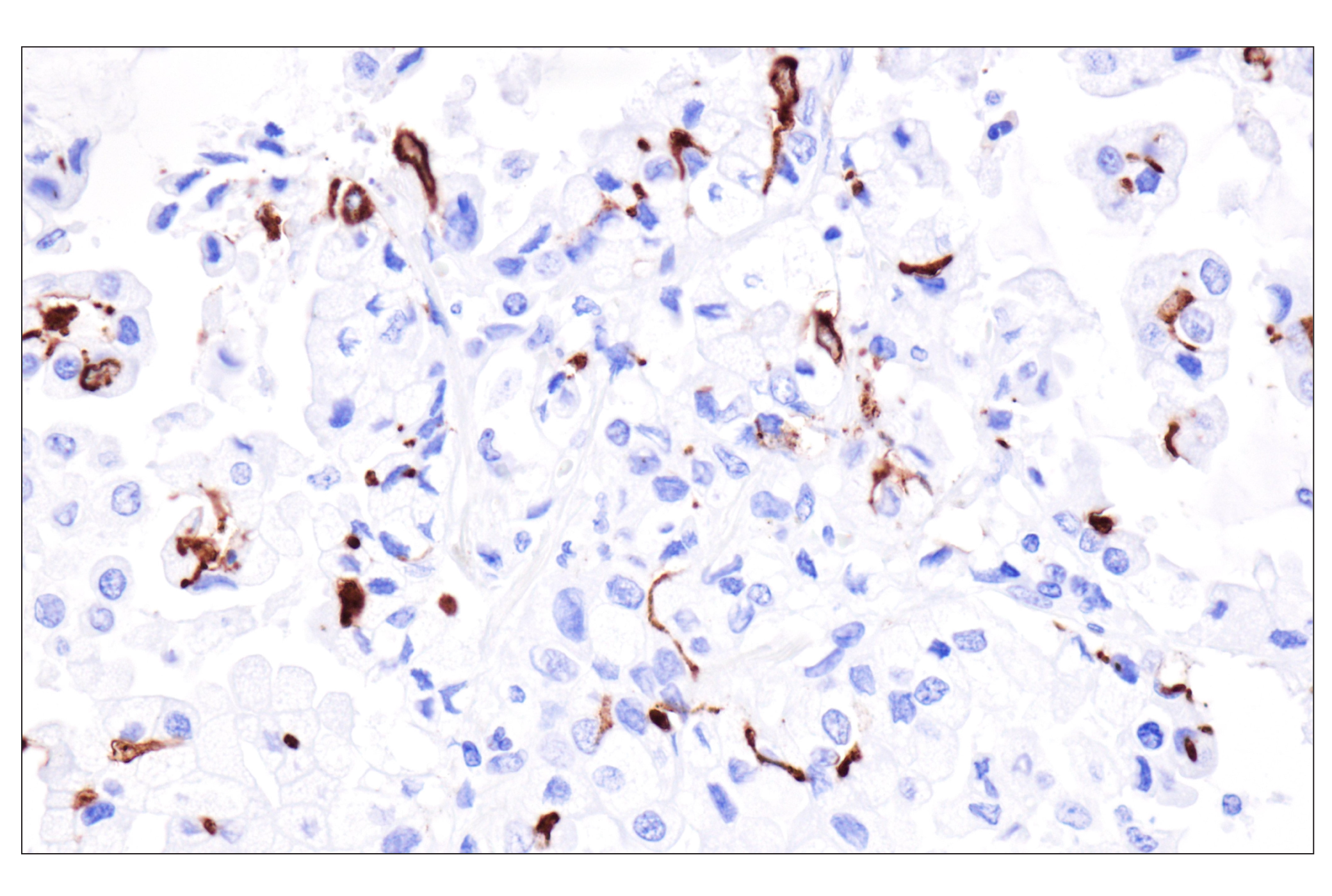 Immunohistochemistry Image 1: Langerin (F8L8I) Rabbit Monoclonal Antibody