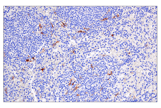 Immunohistochemistry Image 4: Cleaved Gasdermin D (Asp275) (E7H9G) Rabbit mAb