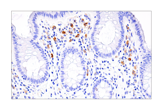 Immunohistochemistry Image 8: Cleaved Gasdermin D (Asp275) (E7H9G) Rabbit mAb