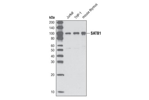 Western Blotting Image 1: SATB1 (P472) Antibody