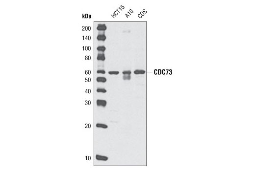 Western Blotting Image 1: CDC73 (A264) Antibody