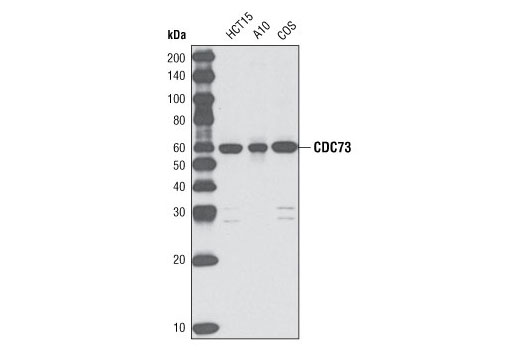 Western Blotting Image 1: CDC73 (D410) Antibody