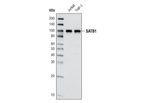 Western Blotting Image 1: SATB1 (L745) Antibody