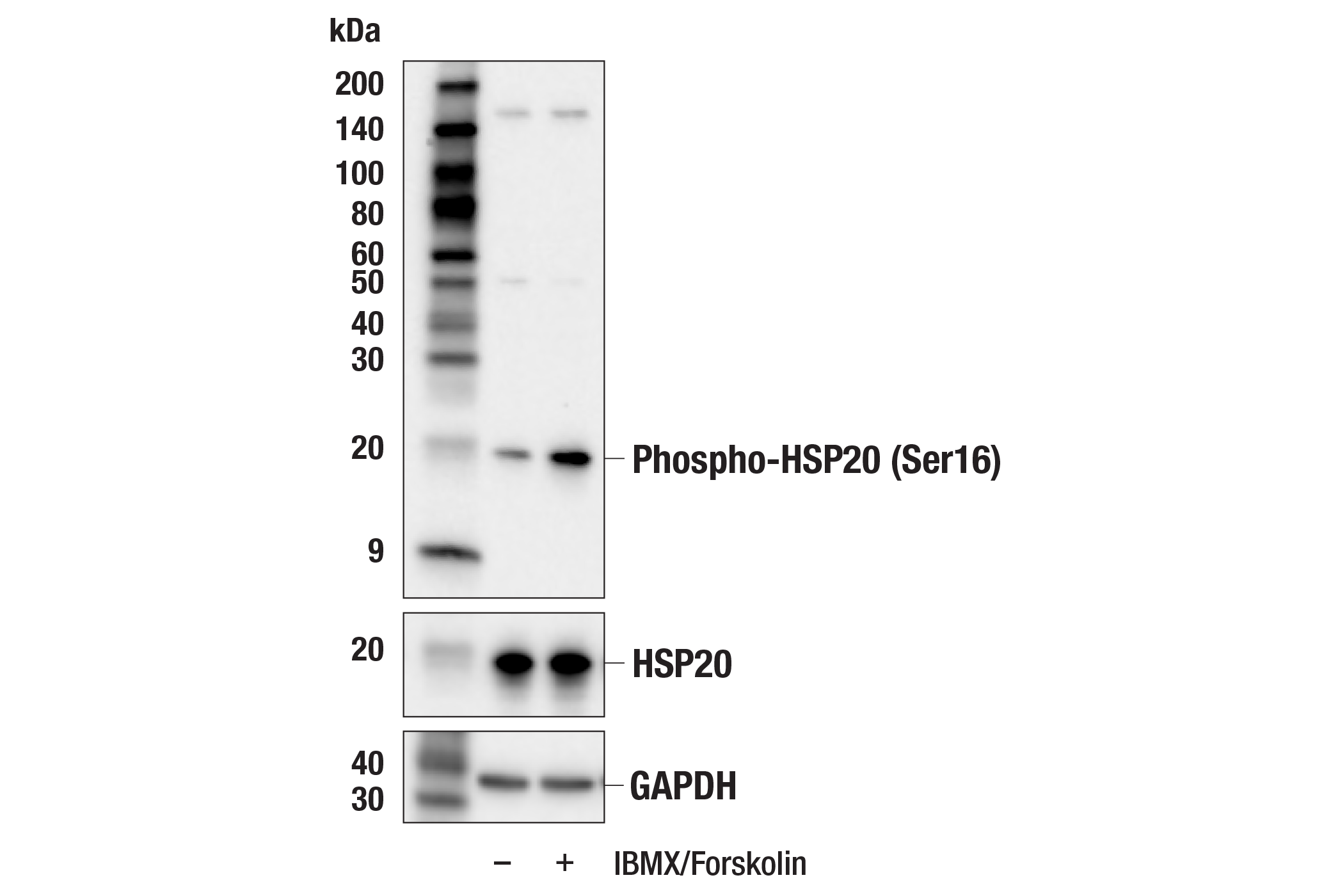 Western Blotting Image 1: Phospho-HSP20 (Ser16) (E4W4X) Rabbit mAb