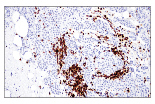 Immunohistochemistry Image 1: CD6 (E9Y7Y) Rabbit mAb (BSA and Azide Free)