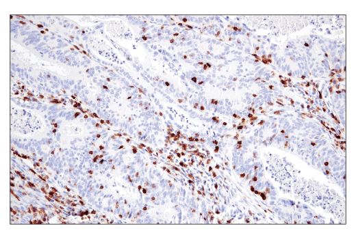 Immunohistochemistry Image 3: CD6 (E9Y7Y) Rabbit mAb (BSA and Azide Free)