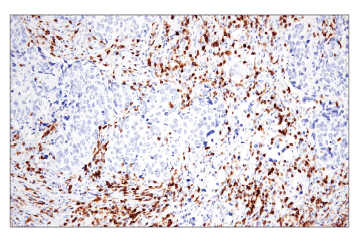 Immunohistochemistry Image 4: CD6 (E9Y7Y) Rabbit mAb (BSA and Azide Free)