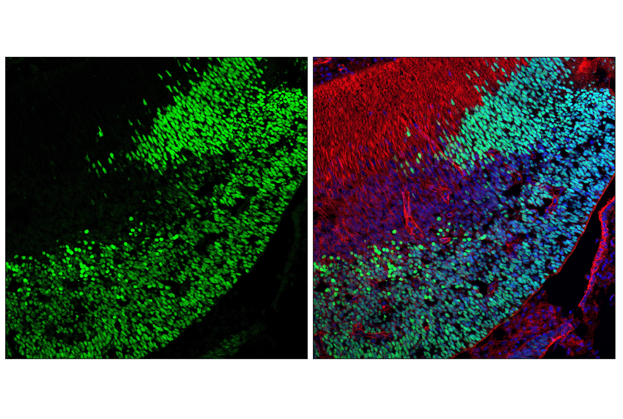 Immunofluorescence Image 1: Sox2 (D9B8N) Rabbit mAb (Alexa Fluor® 488 Conjugate)