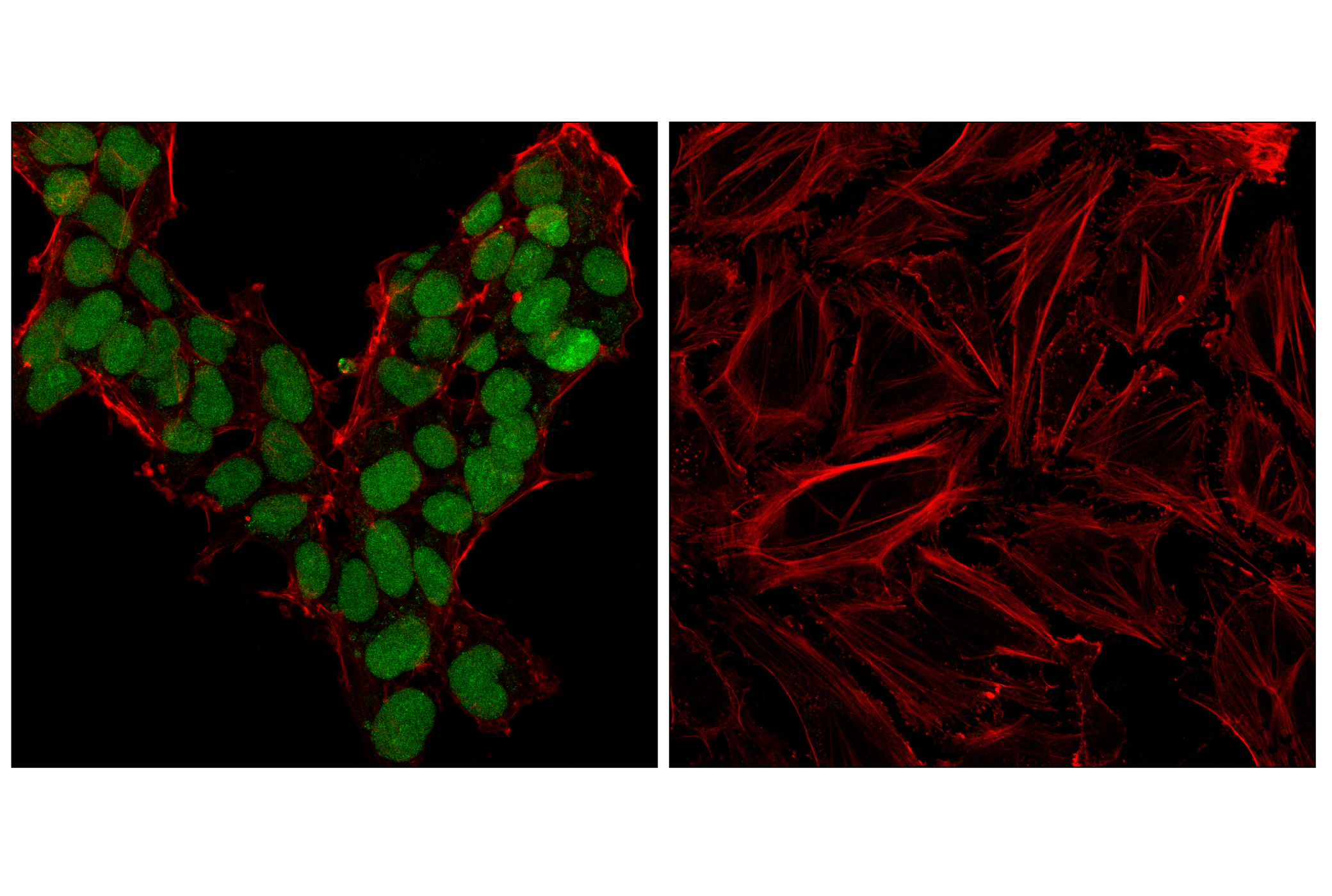 Immunofluorescence Image 2: Sox2 (D9B8N) Rabbit mAb (Alexa Fluor® 488 Conjugate)