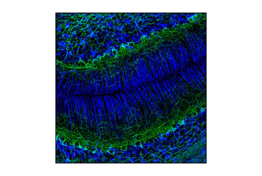 Immunofluorescence Image 1: GFAP (GA5) Mouse mAb (Alexa Fluor® 647 Conjugate)