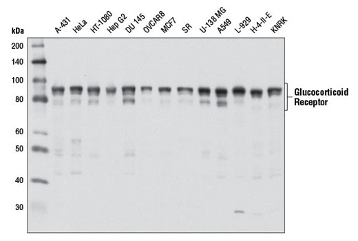 Western Blotting Image 2: Glucocorticoid Receptor (D8H2) XP® Rabbit mAb