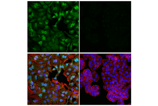Immunofluorescence Image 1: Glucocorticoid Receptor (D8H2) XP® Rabbit mAb