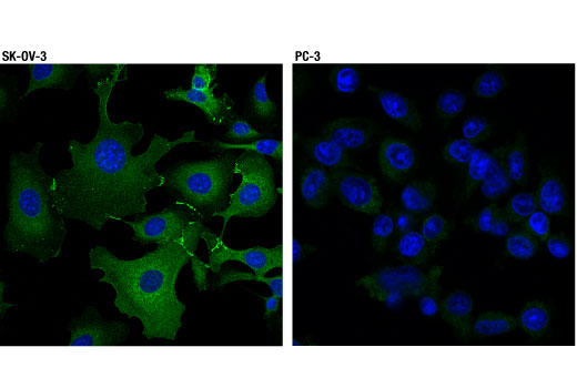 Immunofluorescence Image 1: α-E-Catenin (D9R5E) Rabbit mAb