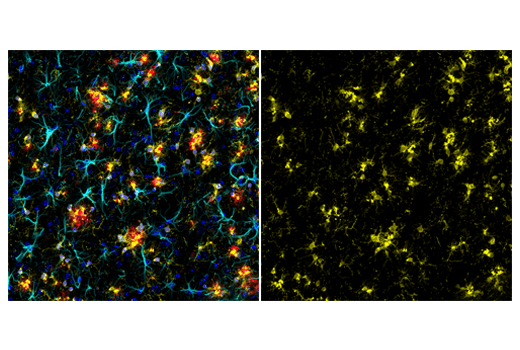 Immunofluorescence Image 1: Iba1/AIF-1 (E4O4W) XP® Rabbit mAb (Alexa Fluor® 555 Conjugate)