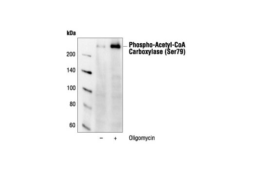 Western Blotting Image 1: Phospho-Acetyl-CoA Carboxylase (Ser79) Antibody