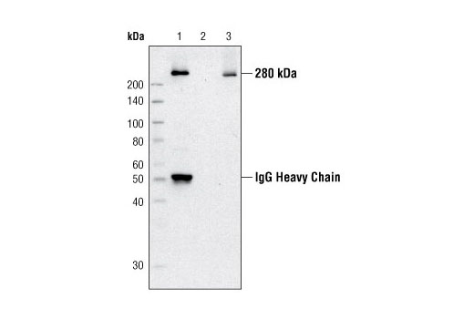 Immunoprecipitation Image 1: Acetyl-CoA Carboxylase Antibody