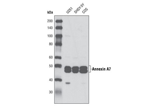 Western Blotting Image 1: Annexin A7 Antibody