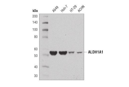 Western Blotting Image 1: ALDH1A1 (D9J7R) XP® Rabbit mAb
