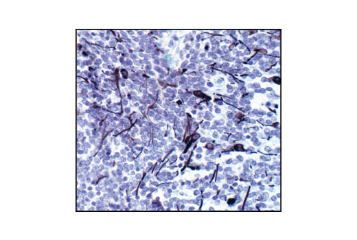 Immunohistochemistry Image 1: GFAP (GA5) Mouse mAb