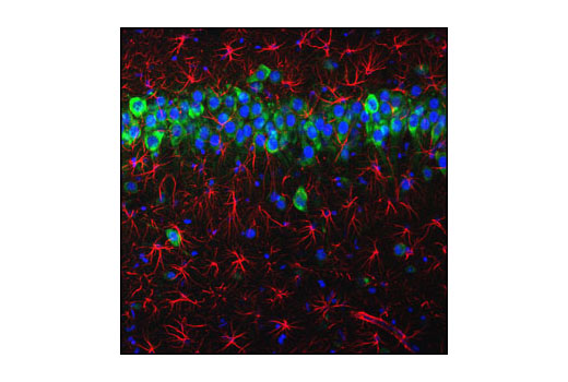  Image 11: Neuronal Marker IF Antibody Sampler Kit II