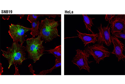 Immunofluorescence Image 2: GFAP (GA5) Mouse mAb