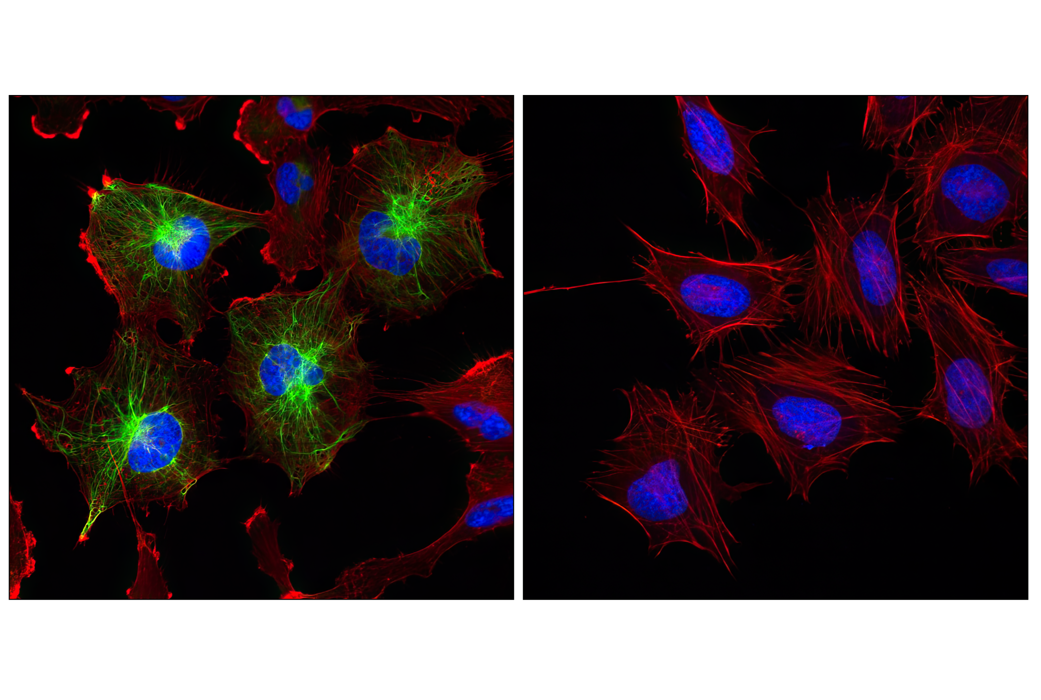 Immunofluorescence Image 2: GFAP (GA5) Mouse mAb