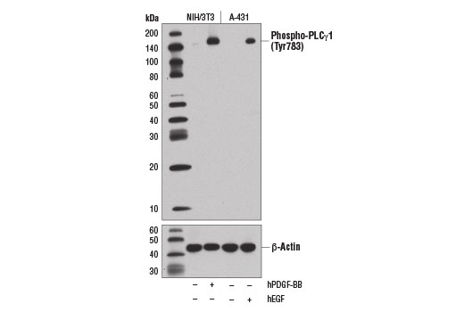 Western Blotting Image 1: Phospho-PLCγ1 (Tyr783) (D6M9S) Rabbit mAb (BSA and Azide Free)